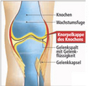 Knorpelaufbau Arthrose